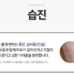 겨울철에 건조해지면 차자오는 고질병 "습진" 습진에 대해~!