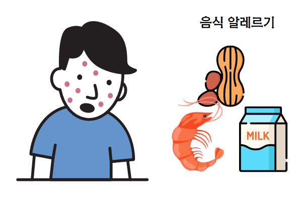 음식 알레르기와 심혈관 질환의 관계: 당신이 알아야 할 5가지 사실