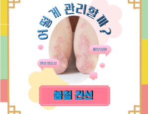 봄철 건선, 어떻게 관리할까? 건선의 원인부터 봄철 특성에 맞는 치료와 예방법