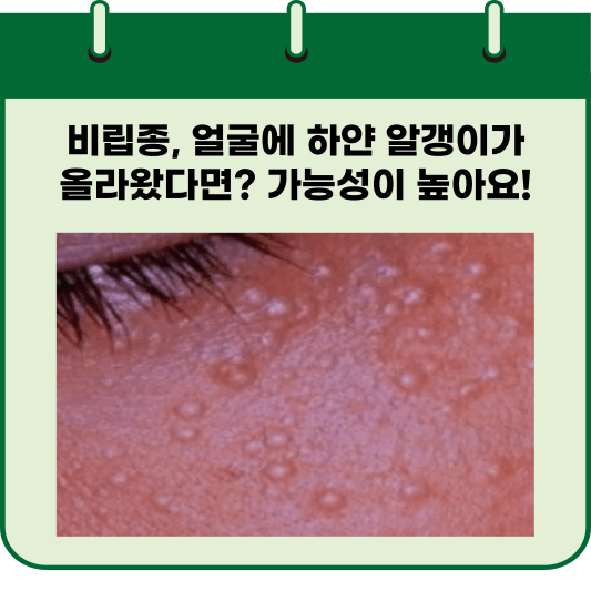 비립종, 얼굴에 하얀 알갱이가 올라왔다면? 가능성이 높아요!