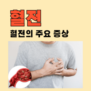 혈전, 어떻게 생기고 증상은? 알아야 할 혈전의 원인과 증상