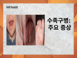 수족구병: 어린이를 위한 완벽 가이드