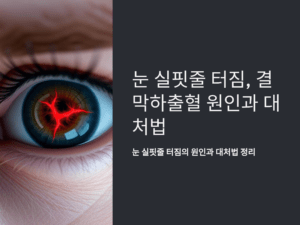 눈 실핏줄 터짐, 결막하출혈 원인과 대처법 완벽 정리!